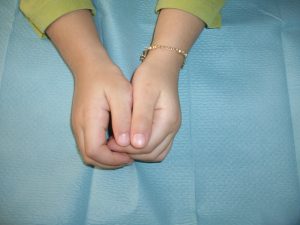 Polidactilias 8 Fig. 7