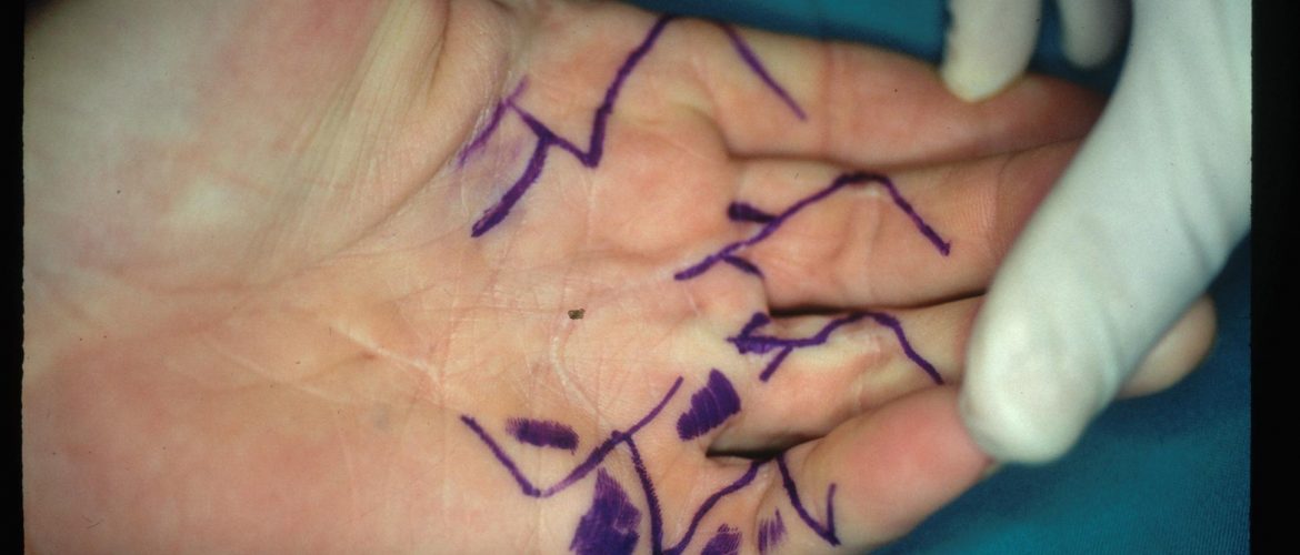 1.1 planeamento pre op