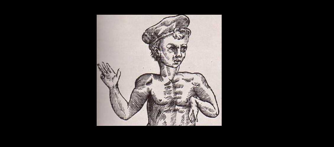 DEFORMIDADES CONGÉNITAS DA MÃO E DO MEMBRO SUPERIOR – GENERALIDADES E INTRODUÇÃO 1 2020 04 11 10