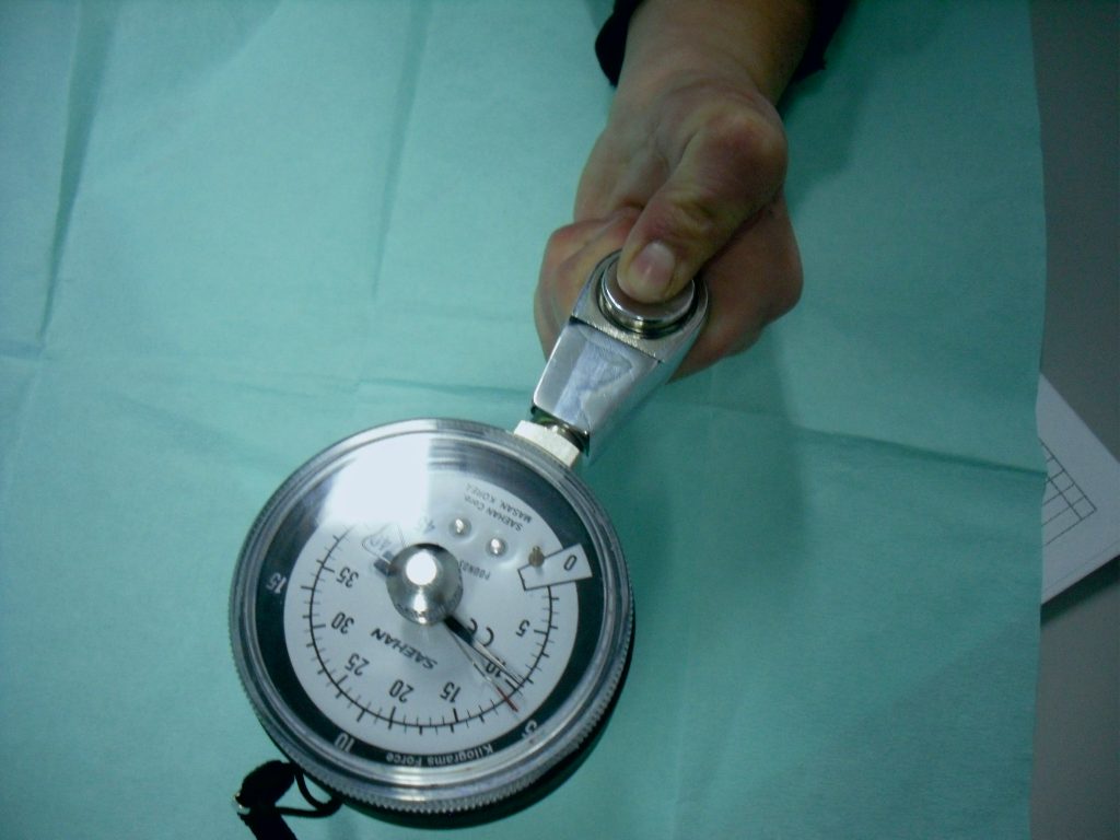 Hipoplasias do polegar 21 34